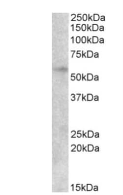 EGR2 Antibody, Novus Biologicals 0.1mg; Unlabeled:Antibodies, Polyclonal
