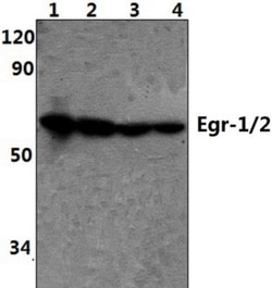EGR2 Antibody - BSA Free, Novus Biologicals 0.025mg; Unlabeled:Antibodies,