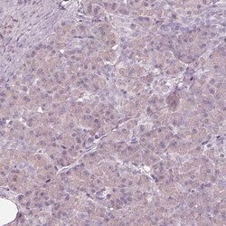 EGR4 Antibody, Novus Biologicals:Antibodies:Primary Antibodies