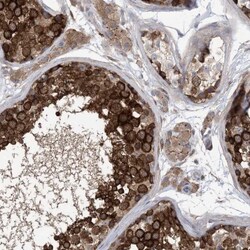 EHBP1 Antibody, Novus Biologicals:Antibodies:Primary Antibodies
