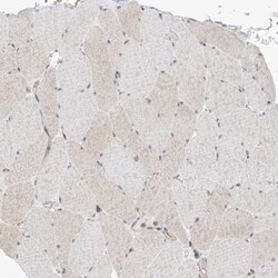 EHBP1 Antibody, Novus Biologicals:Antibodies:Primary Antibodies