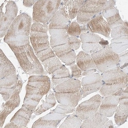 EHBP1 Antibody, Novus Biologicals 25 &mu;L, Unlabeled:Antibodies, Polyclonal