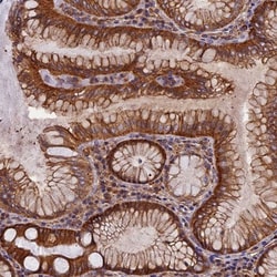 EHBP1L1 Antibody, Novus Biologicals 0.1mL; Unlabeled:Antibodies, Polyclonal
