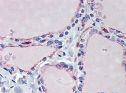 EHD4 Antibody, Novus Biologicals 0.05mg; Unlabeled:Antibodies, Polyclonal
