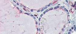EHD4 Antibody, Novus Biologicals 0.05mg; Unlabeled:Antibodies, Polyclonal