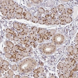 EHF Antibody, Novus Biologicals 25 &mu;L, Unlabeled:Antibodies, Polyclonal