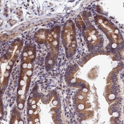 EHM2 Antibody, Novus Biologicals:Antibodies:Primary Antibodies