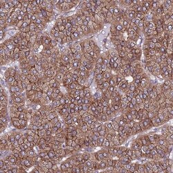 EI24 Antibody, Novus Biologicals 25 &mu;L, Unlabeled:Antibodies, Polyclonal