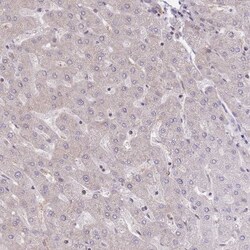 EIF2B2 Antibody, Novus Biologicals 25 &mu;L, Unlabeled:Antibodies, Polyclonal