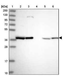 EIF2B2 Antibody, Novus Biologicals 25 &mu;L, Unlabeled:Antibodies, Polyclonal