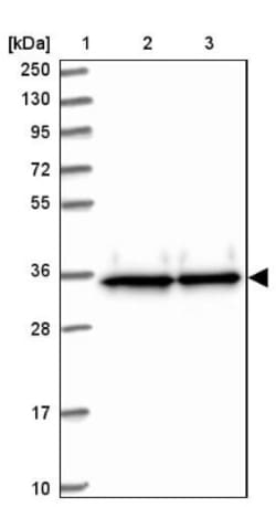 EIF3J Antibody, Novus Biologicals 0.1mL; Unlabeled:Antibodies, Polyclonal
