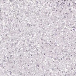 EIG121 Antibody, Novus Biologicals:Antibodies:Primary Antibodies