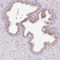 EIG121 Antibody, Novus Biologicals:Antibodies:Primary Antibodies