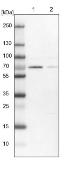 ELF2 Antibody, Novus Biologicals 25 &mu;L; Unlabeled:Antibodies, Polyclonal