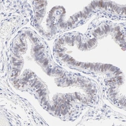 ELF3/ESE-1 Antibody, Novus Biologicals 0.1mL; Unlabeled:Antibodies, Polyclonal