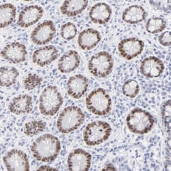 ELF3/ESE-1 Antibody, Novus Biologicals 0.1mL; Unlabeled:Antibodies, Polyclonal