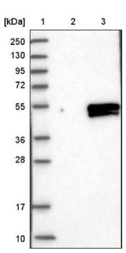 ELF3/ESE-1 Antibody, Novus Biologicals 0.1mL; Unlabeled:Antibodies, Polyclonal