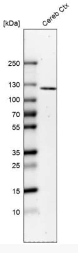 ELFN2 Antibody, Novus Biologicals:Antibodies:Primary Antibodies