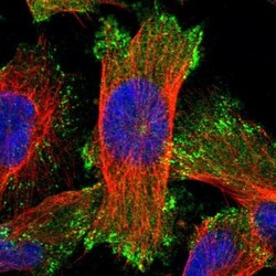 ELKS Antibody, Novus Biologicals 0.1mL; Unlabeled:Antibodies, Polyclonal