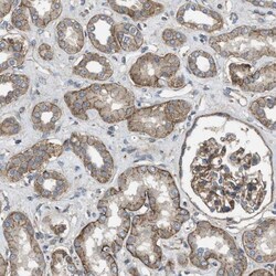 ELKS Antibody, Novus Biologicals 0.1mL; Unlabeled:Antibodies, Polyclonal