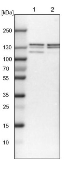 ELKS Antibody, Novus Biologicals 0.1mL; Unlabeled:Antibodies, Polyclonal