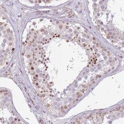ELL Antibody, Novus Biologicals 0.1mL; Unlabeled:Antibodies, Polyclonal