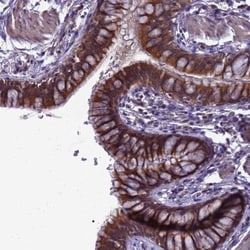ELMOD2 Antibody, Novus Biologicals 0.1mL; Unlabeled:Antibodies, Polyclonal