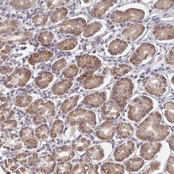 ELOVL1 Antibody, Novus Biologicals:Antibodies:Primary Antibodies