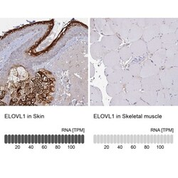 ELOVL1 Antibody, Novus Biologicals:Antibodies:Primary Antibodies
