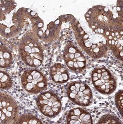 ELOVL6 Antibody, Novus Biologicals:Antibodies:Primary Antibodies