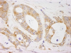 EML4 Antibody, Novus Biologicals 0.1mL; Unlabeled:Antibodies, Polyclonal