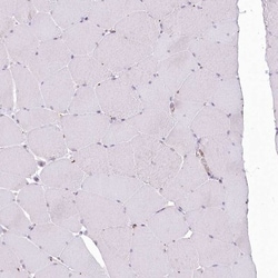 EML4 Antibody, Novus Biologicals 25 &mu;L, Unlabeled:Antibodies, Polyclonal