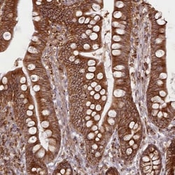 EML4 Antibody, Novus Biologicals 25 &mu;L, Unlabeled:Antibodies, Polyclonal