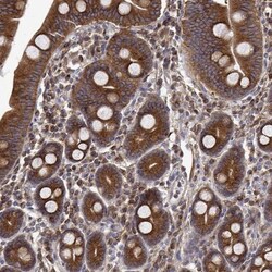 EML4 Antibody, Novus Biologicals:Antibodies:Primary Antibodies