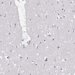 EML4 Antibody, Novus Biologicals:Antibodies:Primary Antibodies