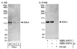 EML4 Antibody, Novus Biologicals 0.1mL; Unlabeled:Antibodies, Polyclonal