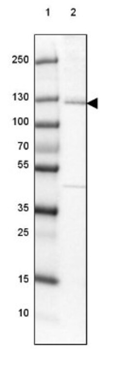 EML4 Antibody, Novus Biologicals:Antibodies:Primary Antibodies