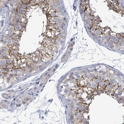 EMMPRIN/CD147 Antibody, Novus Biologicals:Antibodies:Primary Antibodies