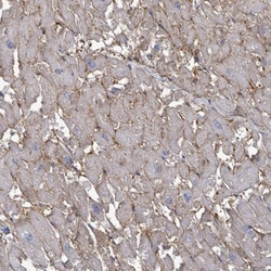 EMMPRIN/CD147 Antibody, Novus Biologicals:Antibodies:Primary Antibodies