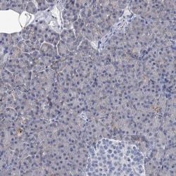 EMMPRIN/CD147 Antibody, Novus Biologicals:Antibodies:Primary Antibodies