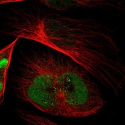 DNMT3A Antibody, Novus Biologicals:Antibodies:Primary Antibodies
