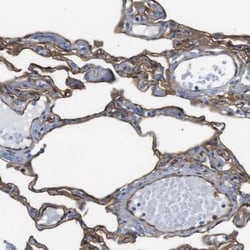 DNMT3A Antibody, Novus Biologicals:Antibodies:Primary Antibodies