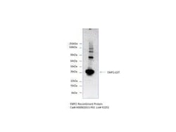 Novus Biologicals Recombinant Human EMP2 GST (N-Term) Protein 10 &mu;g | Buy Online | Novus Biologicals&trade; | Fisher Scientific