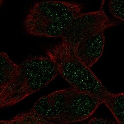 Rabbit anti-EMX2, Polyclonal, Novus Biologicals 0.1mL; Unlabeled:Antibodies,