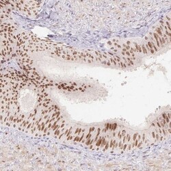 Rabbit anti-EMX2, Polyclonal, Novus Biologicals 0.1mL; Unlabeled:Antibodies,