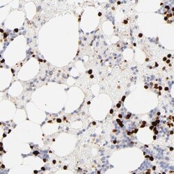 PAK1 Antibody, Novus Biologicals:Antibodies:Primary Antibodies