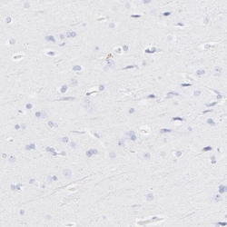 PAK1 Antibody, Novus Biologicals:Antibodies:Primary Antibodies