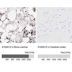 PAK1 Antibody, Novus Biologicals:Antibodies:Primary Antibodies