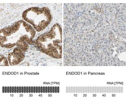 ENDOD1 Antibody, Novus Biologicals 0.1mL; Unlabeled:Antibodies, Polyclonal