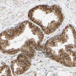 ENDOD1 Antibody, Novus Biologicals 0.1mL; Unlabeled:Antibodies, Polyclonal